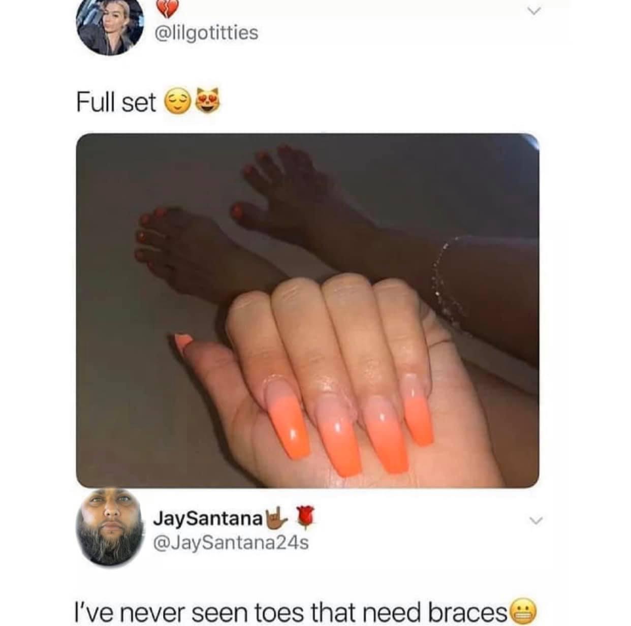 toes that need braces meme - Full set JaySantana I've never seen toes that need braces