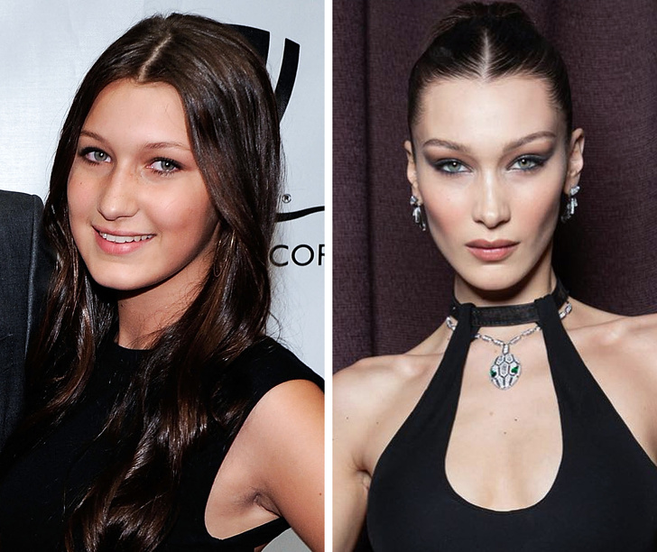 bella hadid before and after - Cof