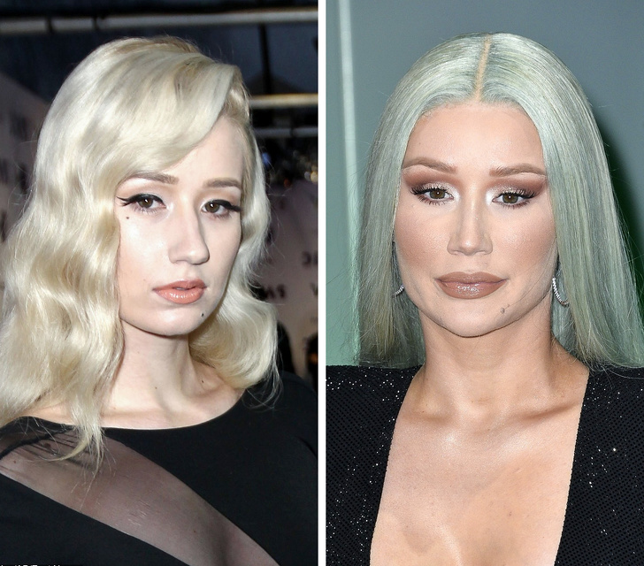 Iggy Azalea