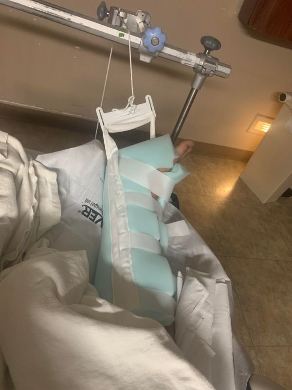 “Second day of the new year, snapped my leg in a climbing accident, no family or friends in town and girlfriend’s gone on a skiing vacation for a week. At least I have pain meds.”