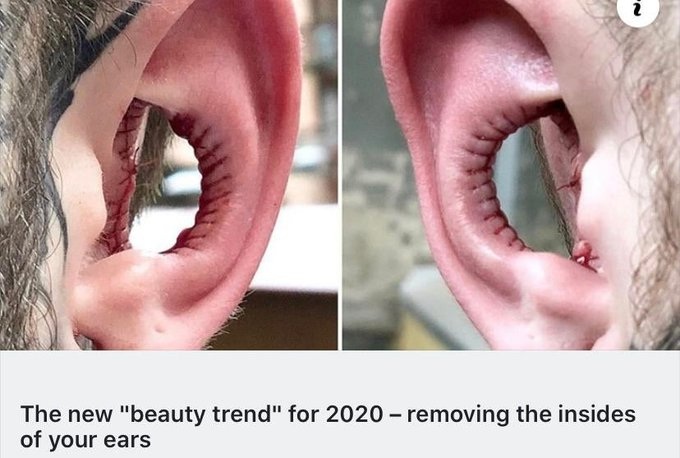 inside ears - The new "beauty trend" for 2020 removing the insides of your ears