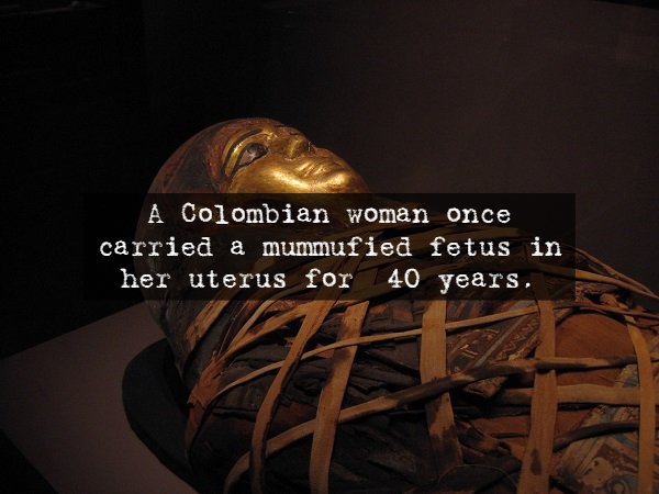 Mummy - A Colombian woman once carried a mummufied fetus in her uterus for 40 years.