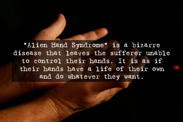 quotes - "Alien Hand Syndrome" is a bizarre disease that leaves the sufferer unable to control their hands. It is as if their hands have a life of their own and do whatever they want.