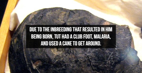 rock - Due To The Inbreeding That Resulted In Him Being Born, Tut Had A Club Foot, Malaria. And Used A Cane To Get Around.