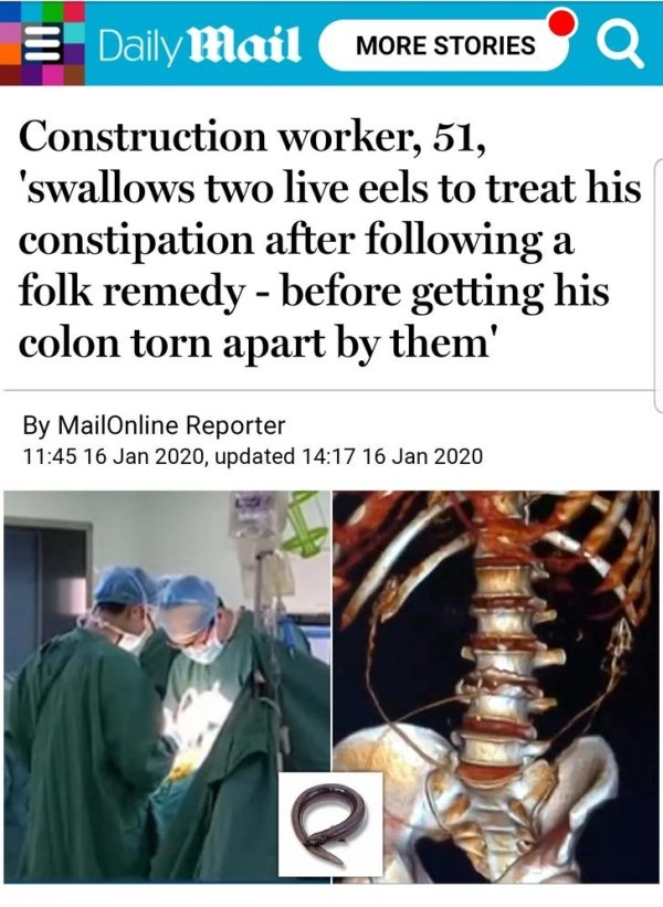 daily mail - E Dailymail More Stories Q Construction worker, 51, 'swallows two live eels to treat his constipation after ing a folk remedy before getting his colon torn apart by them' By MailOnline Reporter , updated