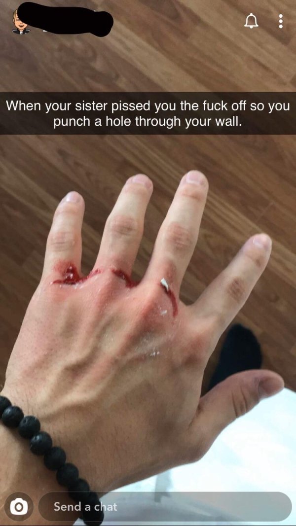 nail - When your sister pissed you the fuck off so you punch a hole through your wall. O Send a chat