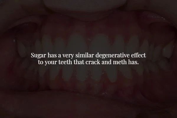 lip - Sugar has a very similar degenerative effect to your teeth that crack and meth has.