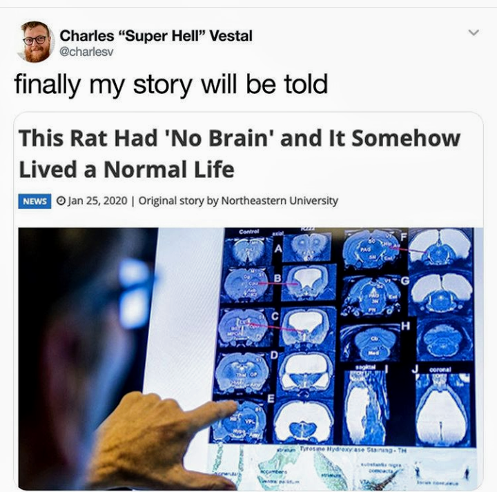 Brain - Charles "Super Hell" Vestal finally my story will be told This Rat Had 'No Brain' and It Somehow Lived a Normal Life News Original story by Northeastern University
