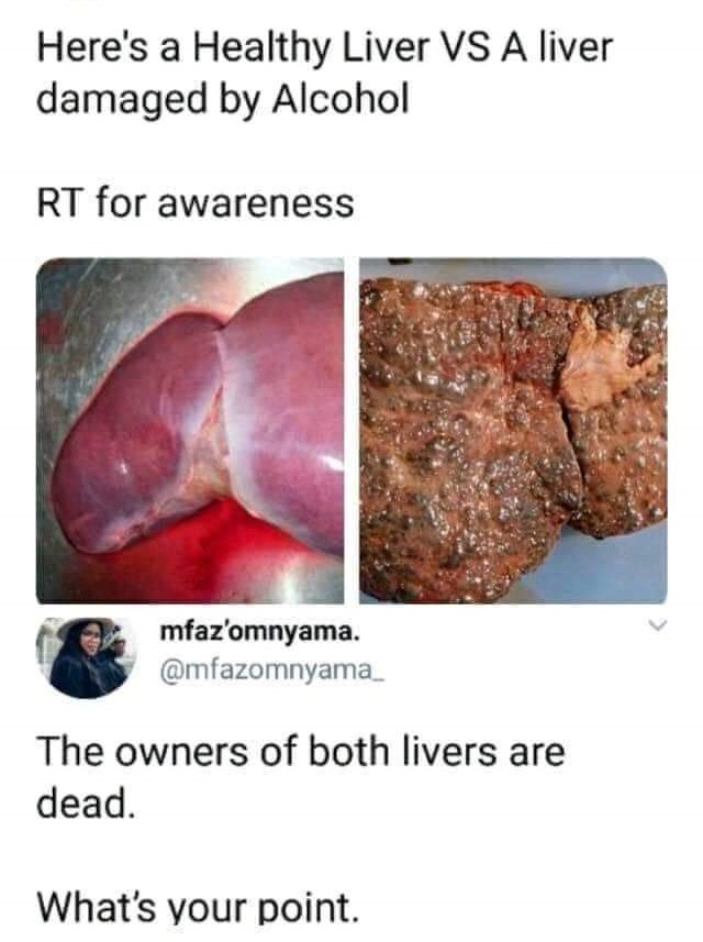 healthy human liver - Here's a Healthy Liver Vs A liver damaged by Alcohol Rt for awareness mfaz'omnyama. The owners of both livers are dead. What's your point.