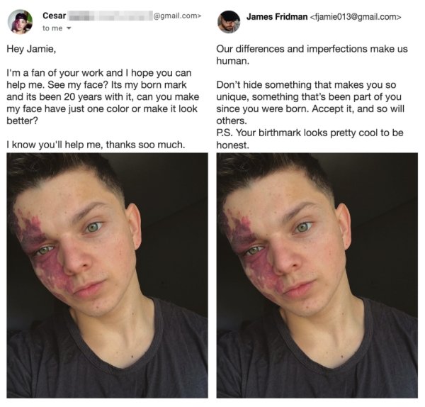 james fridman - .com> Cesar to me James Fridman  93 to Hey Jamie, Our differences and imperfections make us human. I'm a fan of your work and I hope you can help me. See my face? Its my born mark and its been 20 years with it, can you make my face have ju