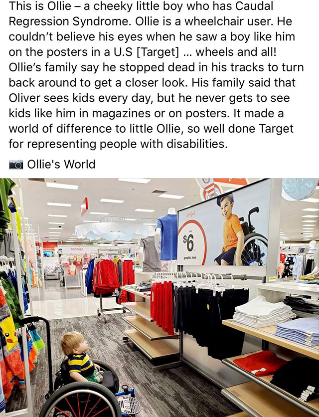 Wheelchair - This is Ollie a cheeky little boy who has Caudal Regression Syndrome. Ollie is a wheelchair user. He couldn't believe his eyes when he saw a boy him on the posters in a U.S Target ... wheels and all! Ollie's family say he stopped dead in his 