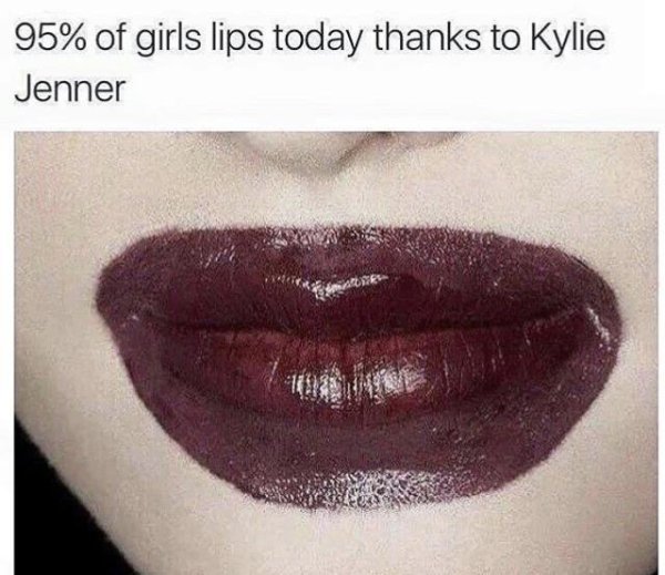 overdrawn lips fails - 95% of girls lips today thanks to Kylie Jenner