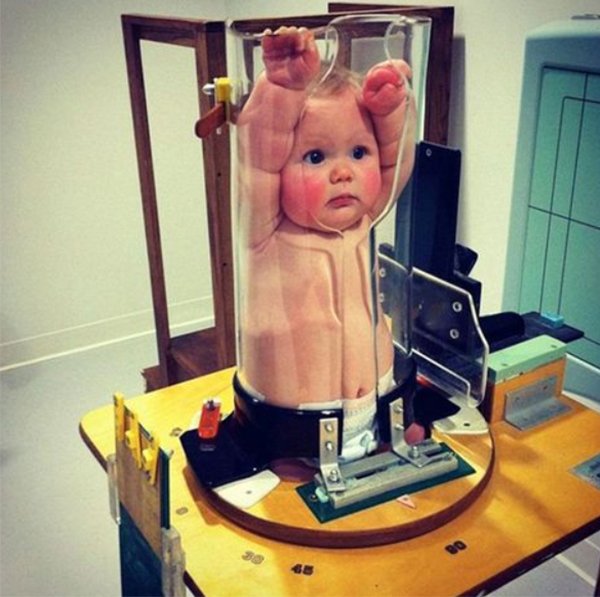 How babies are x-rayed