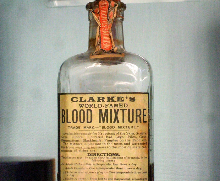 For hundreds of years, up until the 1890s, it was common to use the human body as an ingredient in various medicines. Which human parts were used to treat diseases? Well, pretty much all of them. For instance, the human liver was prescribed to those suffering from epilepsy. But the most common were blood, fat, bone, and flesh. During the 16th and 17th centuries, many physicians actively prescribed corpse medicine to their patients. One of the most popular remedies back in the day was made of smuggled Egyptian mummies. The mummified remains were usually powdered and used as a treatment for epilepsy, bruising, and hemorrhaging.