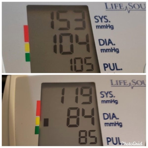 Genetics destined me to have high blood pressure, no matter what I tried. I (31F) finally accepted defeat and started on medication for it today. I don’t think I’ve ever seen it this good! Top was this morning. Bottom was tonight. WOO! I am STOKED!