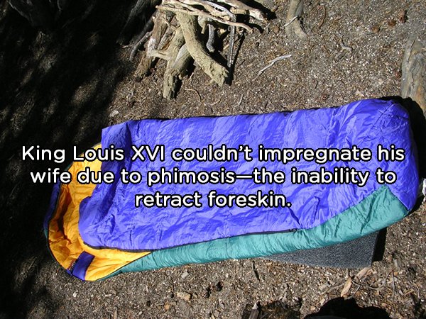 geology - King Louis Xvi couldn't impregnate his wife due to phimosisthe inability to retract foreskin.