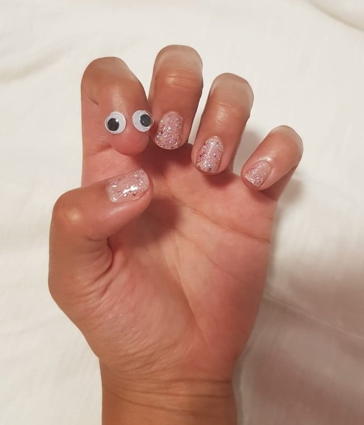 “My girlfriend was born without a nail on her index finger. So in response to many requests, we put googly eyes on it!”