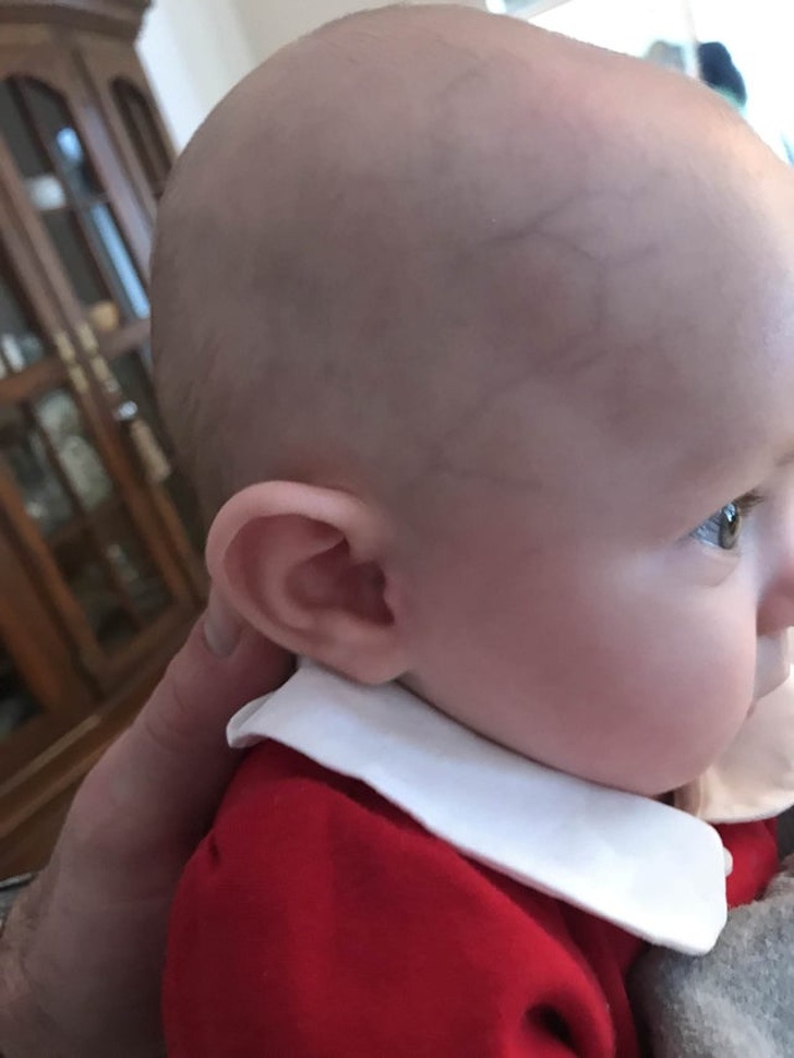 “My daughter was born with a perfect 2 on her head.”