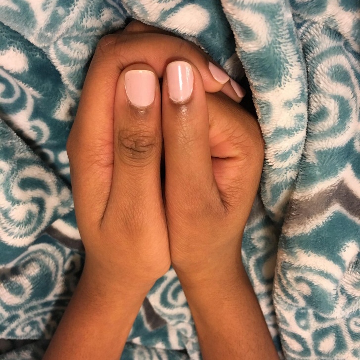 “I was born with a condition where my right thumb is unable to bend. You can see it by the smooth skin on the spot where it’s usually supposed to bend.”