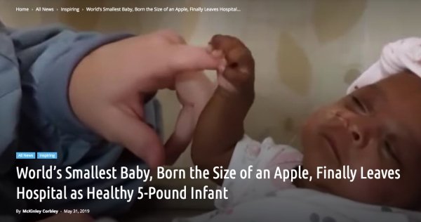 Home All News Inspiring Worlds Smallest Baby, Bom the size of an Apple. Finally leaves Hospital... All Newm an World's Smallest Baby, Born the Size of an Apple, Finally Leaves 'Hospital as Healthy 5Pound Infant By McKinley Cerbley