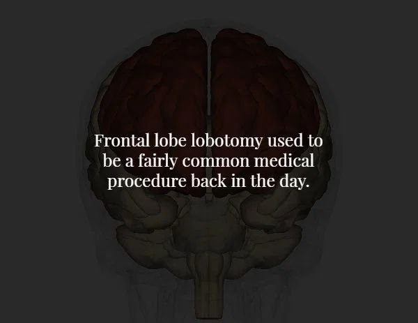 brain - Frontal lobe lobotomy used to be a fairly common medical procedure back in the day.