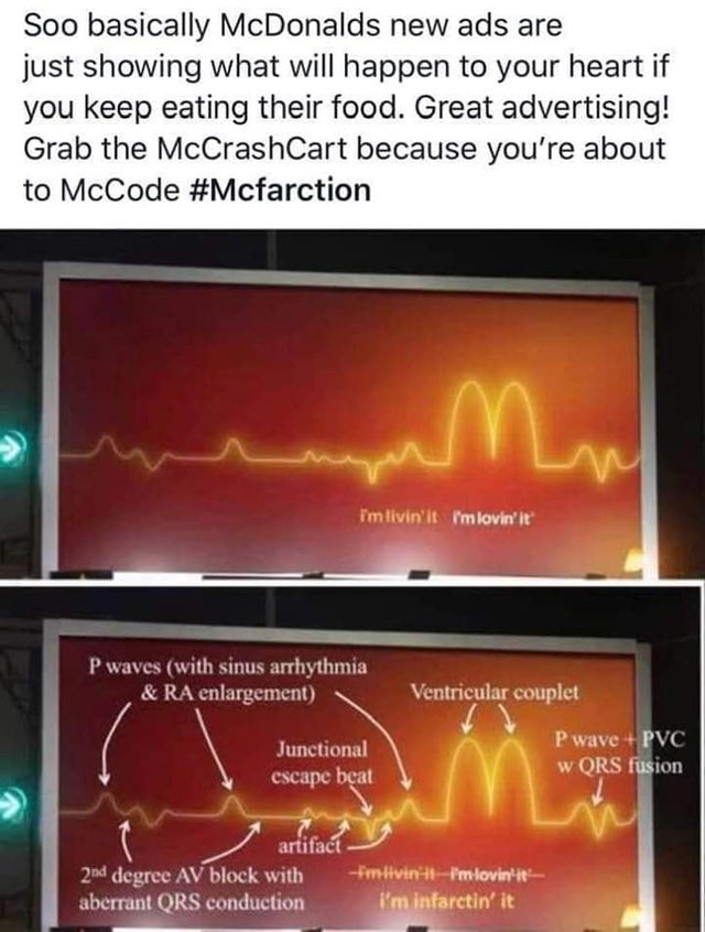 Medical school - Soo basically McDonalds new ads are just showing what will happen to your heart if you keep eating their food. Great advertising! Grab the McCrashCart because you're about to McCode I'm livin' it I'm lovin' it Pwaves with sinus arrhythmia