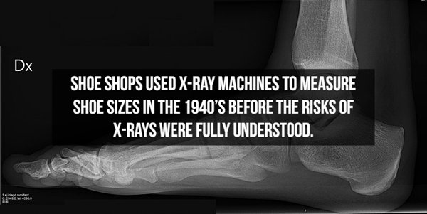 boo squad - Dx Shoe Shops Used XRay Machines To Measure Shoe Sizes In The 1940'S Before The Risks Of XRays Were Fully Understood.