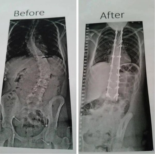 radiology - Before After