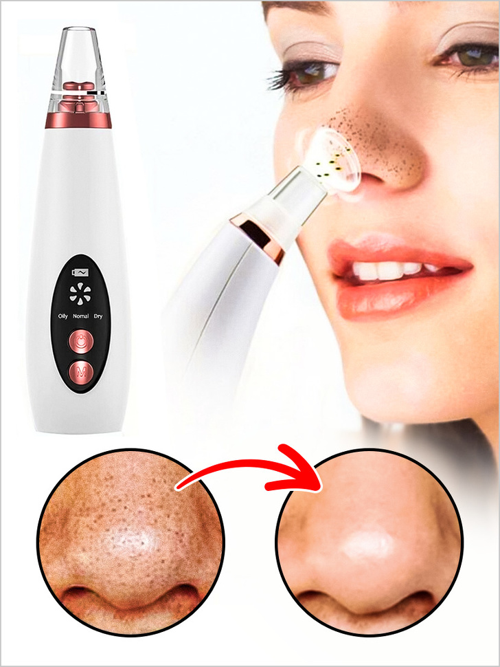 A vacuum cleaner for removing blackheads