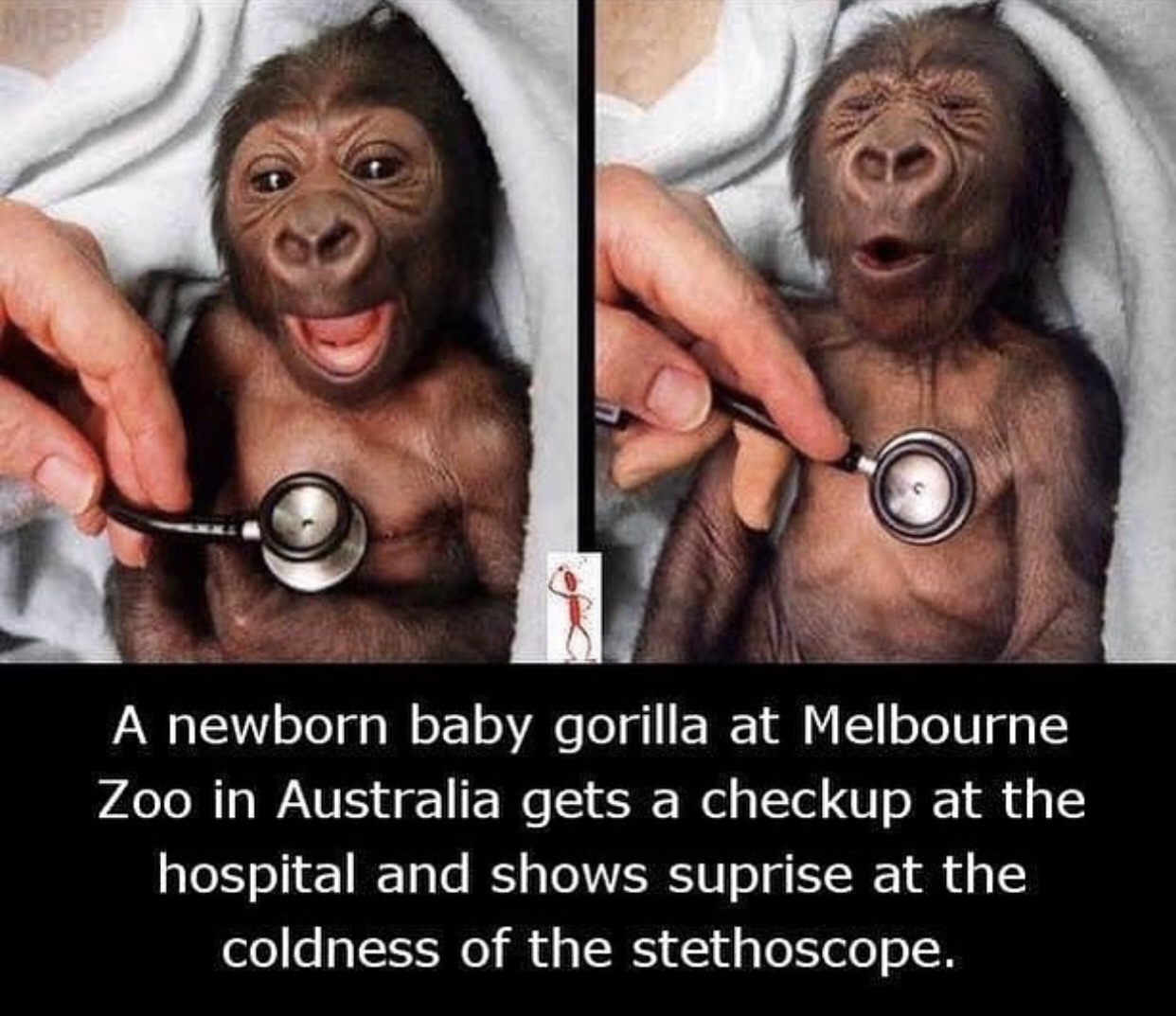 baby gorilla cold stethoscope - A newborn baby gorilla at Melbourne Zoo in Australia gets a checkup at the hospital and shows suprise at the coldness of the stethoscope.