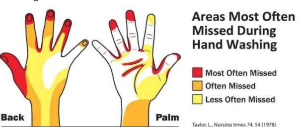 wash your hands - Areas Most Often Missed During Hand Washing Most Often Missed Often Missed Less Often Missed Back Palm Taylor L. Nursing times 74,54 1978