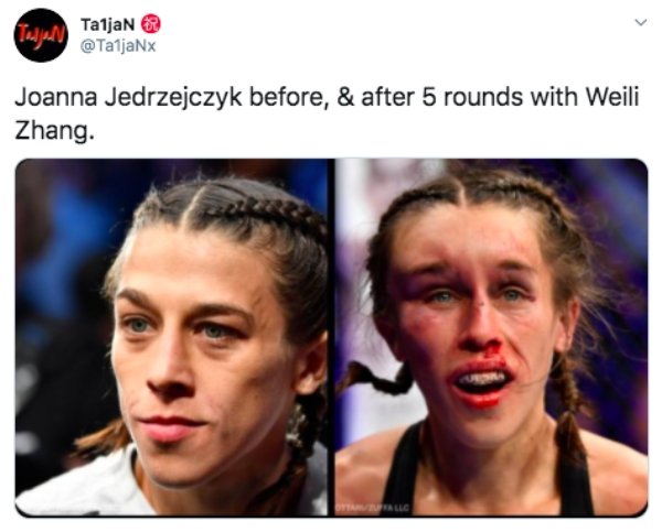 joanna jedrzejczyk - Tasjad Taljan Joanna Jedrzejczyk before, & after 5 rounds with Weili Zhang.