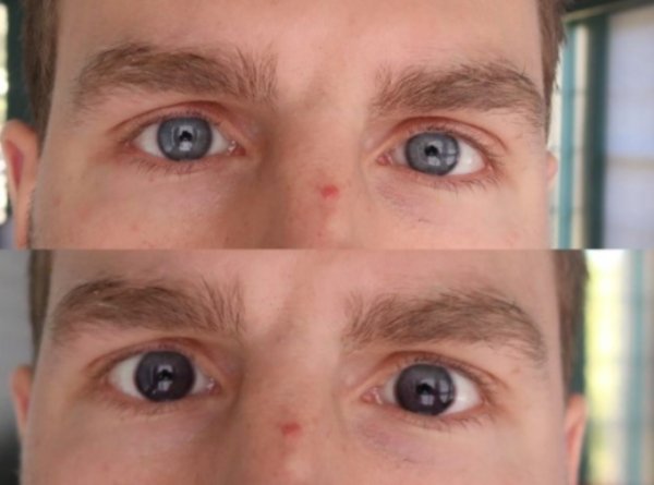 transition contacts before and after