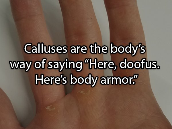 nail - Calluses are the body's way of saying "Here, doofus. Here's body armor."