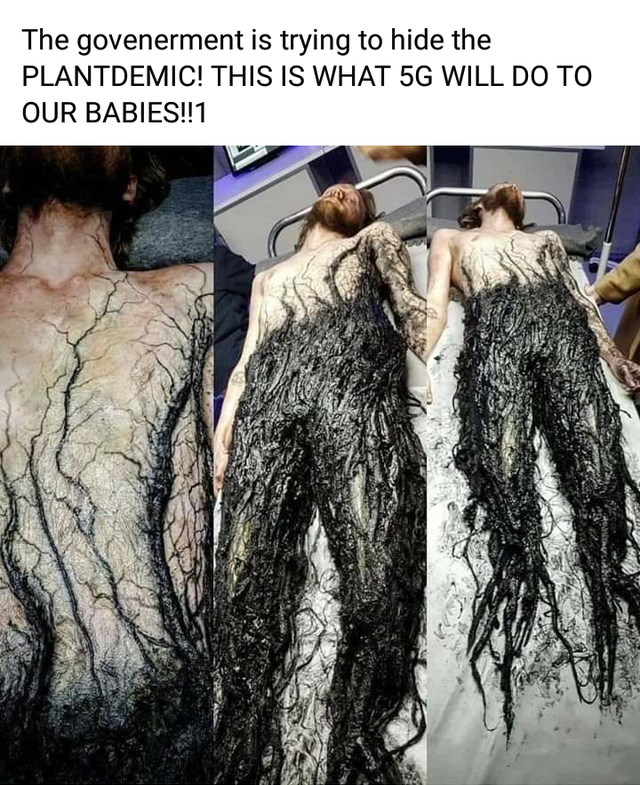 fur - The govenerment is trying to hide the Plantdemic! This Is What 5G Will Do To Our Babies!!1