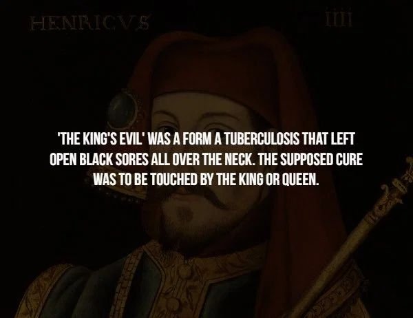 screenshot - Henricvs 'The King'S Evil' Was A Form A Tuberculosis That Left Open Black Sores All Over The Neck. The Supposed Cure Was To Be Touched By The King Or Queen.