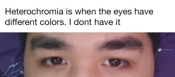 lip - Heterochromia is when the eyes have different colors. I dont have it