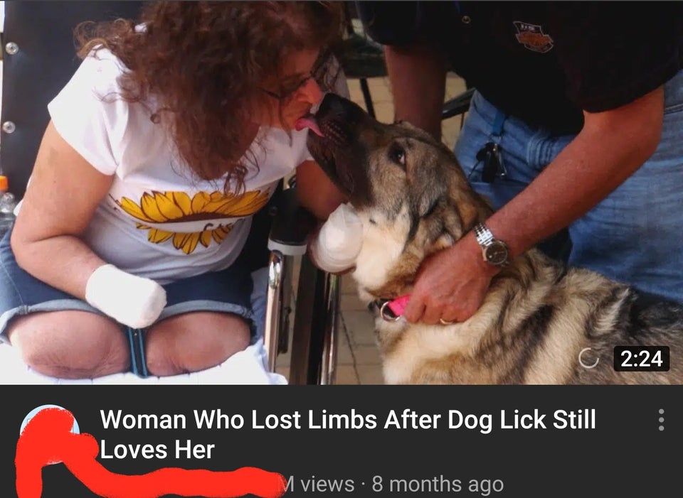 dog - Woman Who Lost Limbs After Dog Lick Still Loves Her M views 8 months ago
