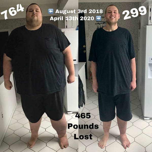 morbid obesity m - 764 7 August 3rd 2018 April 13th 2020 7465 Pounds Lost
