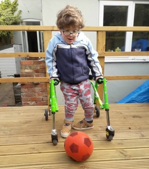 six year old boy with Spina bifida