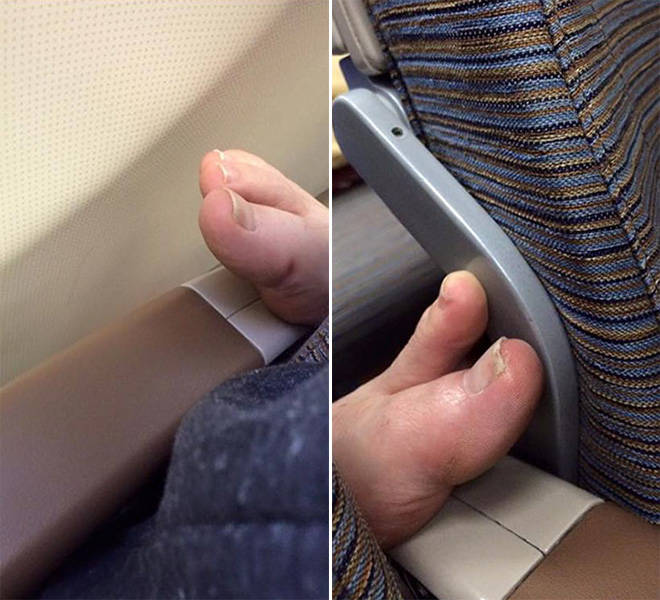 Disgusting dirty feet with gross toenails on airplane