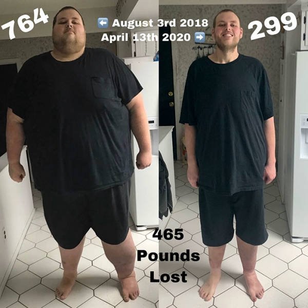 morbid obesity m - 764 August 3rd 2018 April 13th 2020 765 Pounds Lost