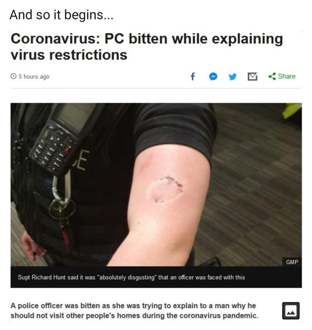 derma roller - And so it begins... Coronavirus Pc bitten while explaining virus restrictions f y 5 hours ago Gmp Supt Richard Hunt said it was "absolutely disgusting" that an officer was faced with this A police officer was bitten as she was trying to exp