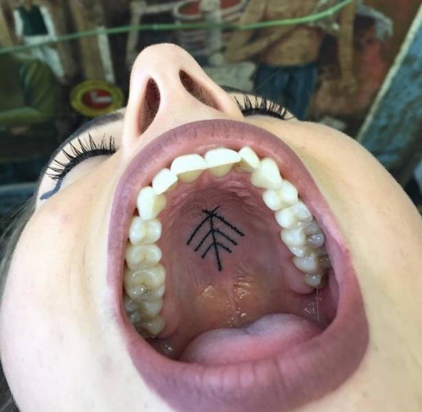 roof of mouth