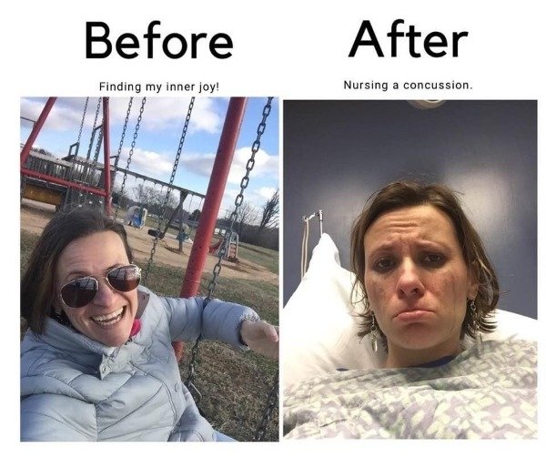 selfie - Before After Finding my inner joy! Nursing a concussion.