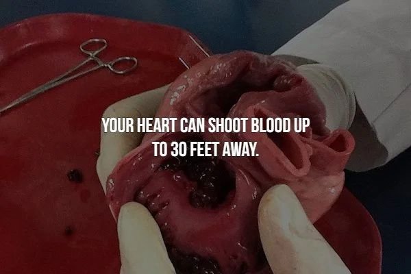 Your Heart Can Shoot Blood Up To 30 Feet Away.