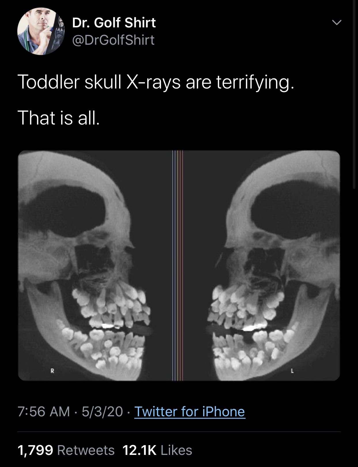 baby skull x ray - Dr. Golf Shirt Toddler skull Xrays are terrifying. That is all. 5320 Twitter for iPhone 1,799