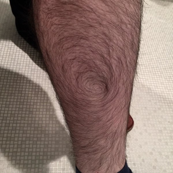 spiral leg hair