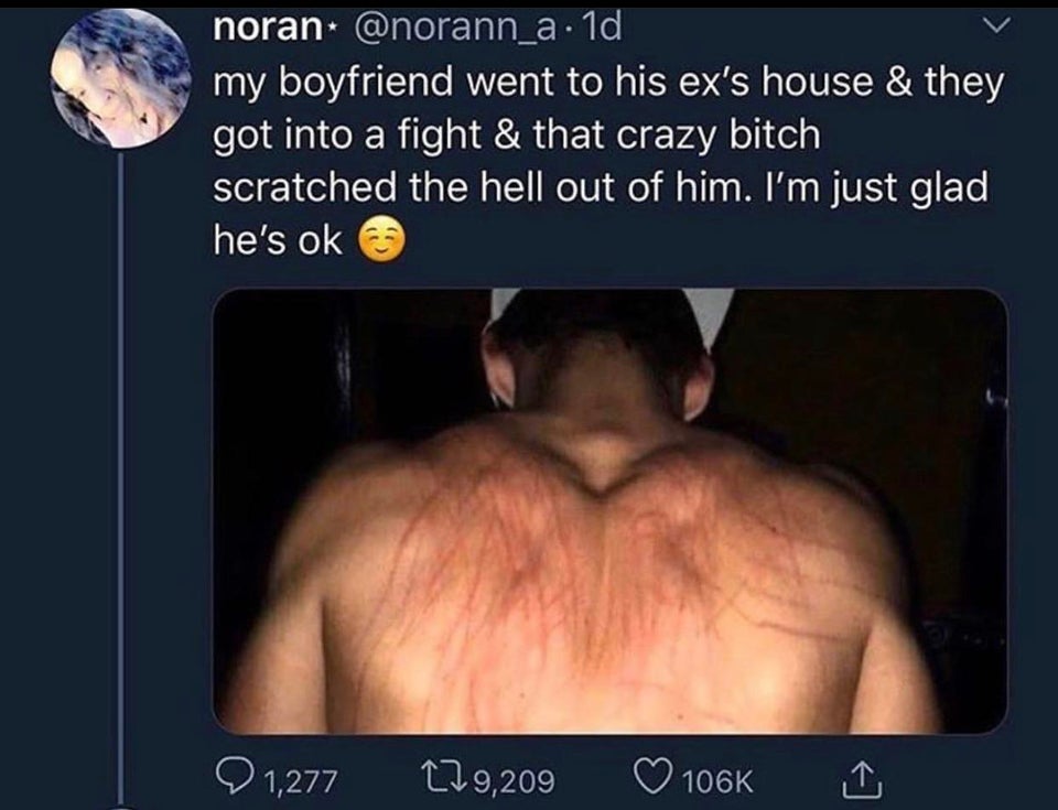 photo caption - noran . 1d my boyfriend went to his ex's house & they got into a fight & that crazy bitch scratched the hell out of him. I'm just glad he's ok 21,277 179,209