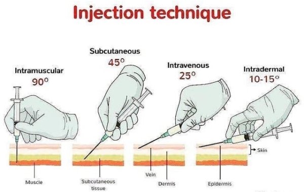 Injection technique Subcutaneous 45 Intramuscular 90 Intravenous 25 Intradermal 1015 los Skin Vein Muscle Subcutaneous tissue Dermis Epidermis